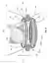 Fig. 10 - Implantation device