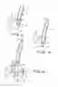 Fig. 06 - Percutaneous aortic valve