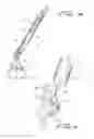 Fig. 07 - Percutaneous aortic valve