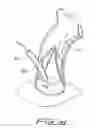 Fig. 17 - Percutaneous aortic valve