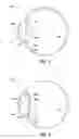 Fig. 02 - APPARATUS, SYSTEM AND METHOD FOR PROVIDING A COATING FOR AN IMPLANATABLE LENS