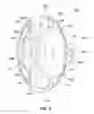 Fig. 06 - APPARATUS, SYSTEM AND METHOD FOR PROVIDING A COATING FOR AN IMPLANATABLE LENS