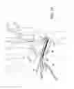 Fig. 19 - SCAPHOLUNATE CONSTRUCT AND RECONSTRUCTION