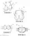 Fig. 05 - Biologic diarthrodial joint