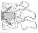Fig. 01 - Push-in interbody spinal fusion implants for use with self-locking screws