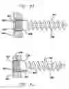Fig. 15 - Push-in interbody spinal fusion implants for use with self-locking screws