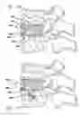 Fig. 22 - Push-in interbody spinal fusion implants for use with self-locking screws
