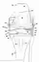 Fig. 01 - KNEE JOINT ENDOPROSTHESIS