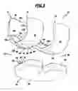 Fig. 04 - KNEE JOINT ENDOPROSTHESIS