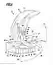 Fig. 07 - KNEE JOINT ENDOPROSTHESIS