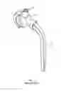 Fig. 02 - EXTENDED LIFE PROSTHETIC HIP JOINT