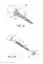 Fig. 04 - Minimally invasive total hip replacement