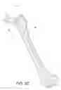 Fig. 06 - Minimally invasive total hip replacement