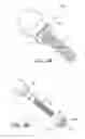Fig. 10 - Minimally invasive total hip replacement