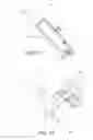 Fig. 16 - Minimally invasive total hip replacement