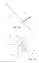 Fig. 18 - Minimally invasive total hip replacement