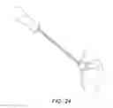 Fig. 24 - Minimally invasive total hip replacement