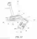 Fig. 27 - Minimally invasive total hip replacement