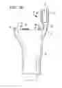 Fig. 03 - Soft tissue attachment mechanism