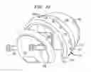 Fig. 30 - Soft tissue attachment mechanism
