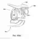 Fig. 10 - URETHRAL ANASTOMOSIS DEVICE