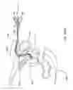 Fig. 13 - URETHRAL ANASTOMOSIS DEVICE
