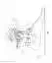 Fig. 08 - Passive ankle prosthesis with energy return simulating that of a natural ankle