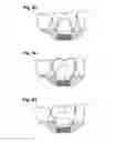 Fig. 06 - Method for automatically fabricating a dental superstructure for attachment to an implant