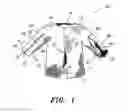 Fig. 02 - GARMENT HAVING SLEEVES