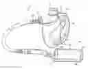 Fig. 01 - Steam cleaner including a quick release coupling for a cleaning tool