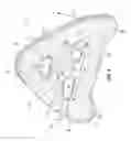 Fig. 04 - Surface cleaner including a cleaning pad