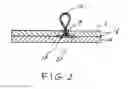 Fig. 03 - Sandal and strap assembly