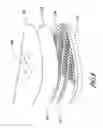 Fig. 07 - Resilient shoe with pivoting sole