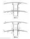 Fig. 08 - Apparatus and methods for eliminating cracking in a turbine exhaust shield