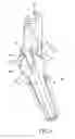 Fig. 07 - Pressure sensor and nozzle assembly