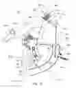 Fig. 06 - Stuffing device