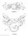 Fig. 28 - Opposed-piston, opposed-cylinder engine with collinear cylinders