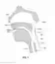 Fig. 02 - SYSTEM AND METHODS OF INTUBATION