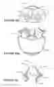 Fig. 32 - Breathing assistance apparatus