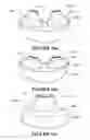 Fig. 44 - Breathing assistance apparatus