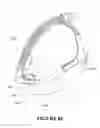 Fig. 76 - Breathing assistance apparatus