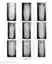 Fig. 02 - Stable, non-corrosive formulations for pressurized metered dose inhalers