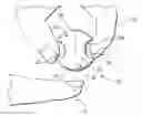 Fig. 01 - Apparatus and method for removing fingernail polish