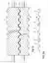 Fig. 03 - Method of making multilayer product having honeycomb core