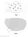 Fig. 02 - Well treatment
