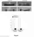 Fig. 09 - Prohealing endovascular devices