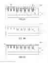 Fig. 07 - Trench schottky diode and manufacturing method thereof
