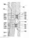 Fig. 01 - Anchoring seal