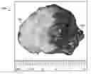 Fig. 01 - System and method for modeling a biopsy specimen