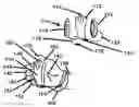Fig. 01 - PERSONAL SECURITY DEVICE